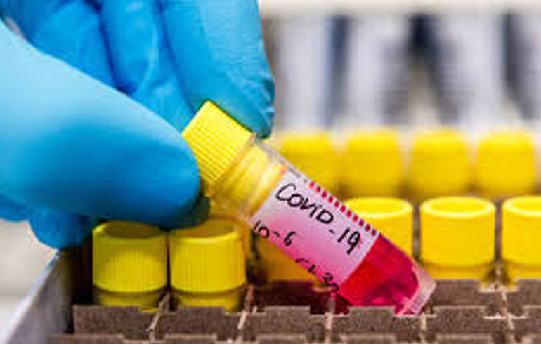 Ghana: 408 out of 27,346 Test Positive For COVID-19, 8 Dead