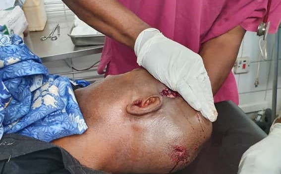 N/R: TV Africa's Correspondent Sustains Gunshot Wound in Head