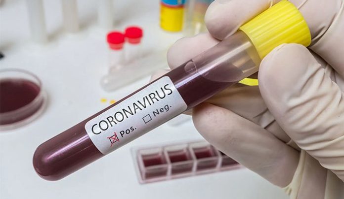 Over 50,000 Samples for COVID-19 tested in Ghana