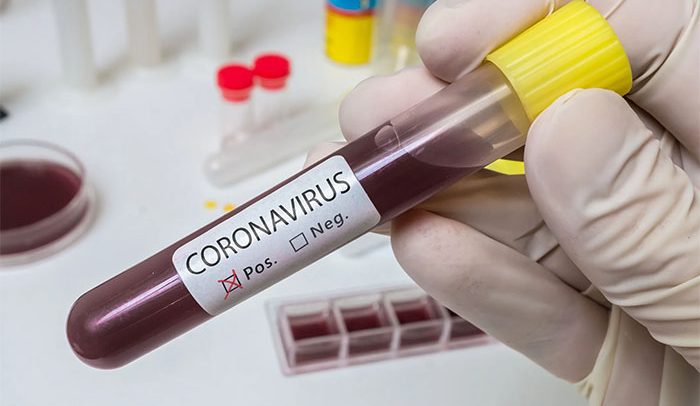 Pregnant Nurse infected with Coronavirus in Koforidua