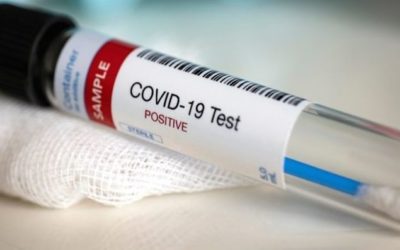 COVID-19: 4 Females, 3 Males Die, Close to 1k Persons Test Positive In Ghana