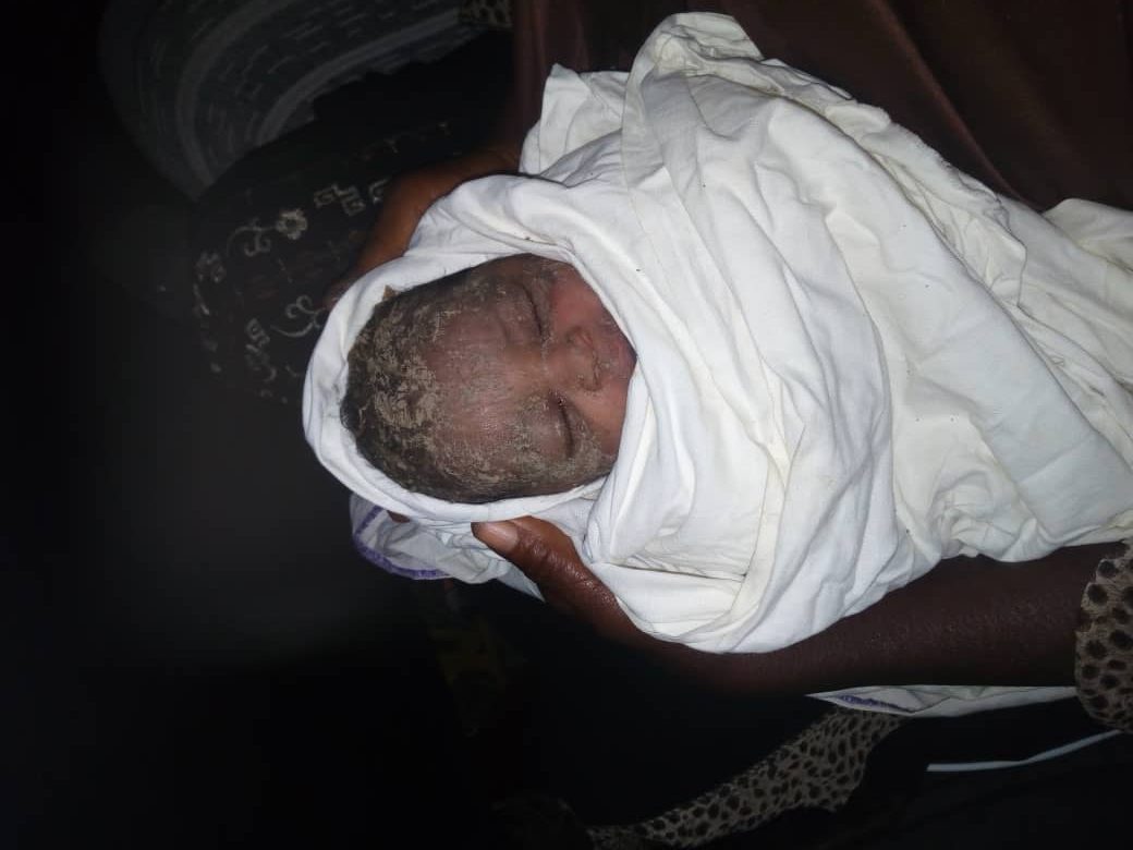 C/R: Newborn Baby Buried Alive Rescued
