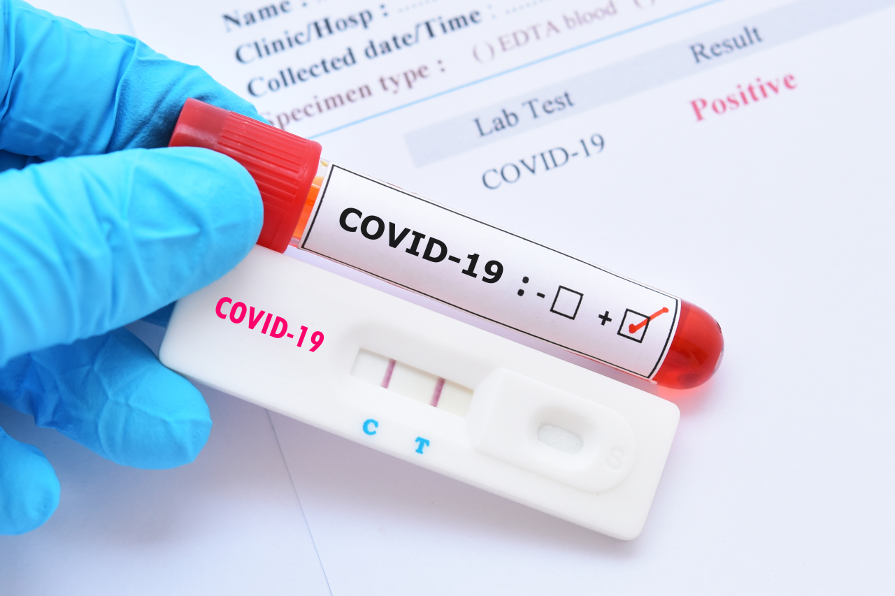 Ghana's COVID-19 Cases Rise to 1,139