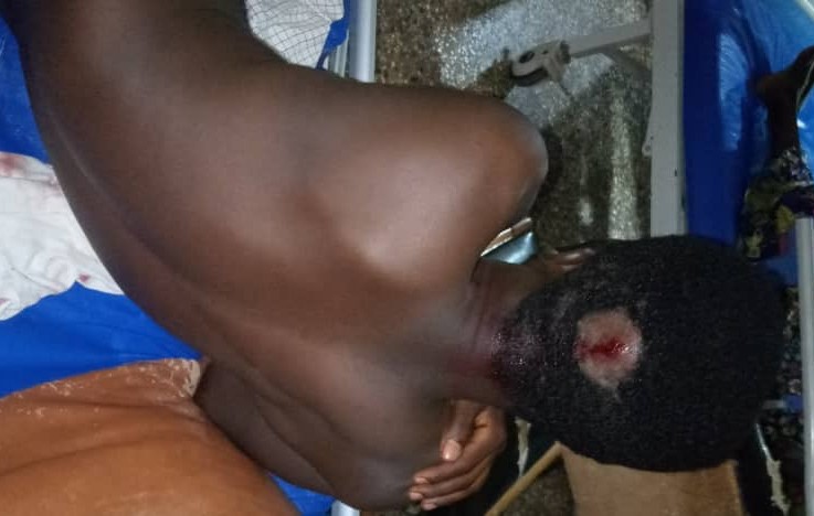 Armed Robbers Shoot Mobile Money Vendor, 7 Others in Asesewa, Residents Gripped With Fear