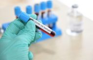COVID-19: 888 Cases in Ghana Now