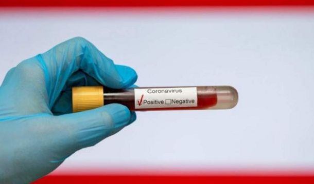 COVID 19: Ghana Records Six New Deaths, Cases Jumped to 3,286