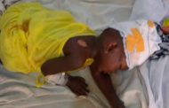 E/R: Mother, Baby in Hospital after Antelope Crossed their Speeding Motorbike