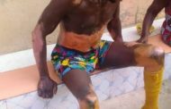Koforidua: Wife Dies, Husband and Baby Injured in Gas Explosion