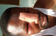 Teacher Beaten to Pulp by Thugs Brought By JHS Student He Punished Over Homework
