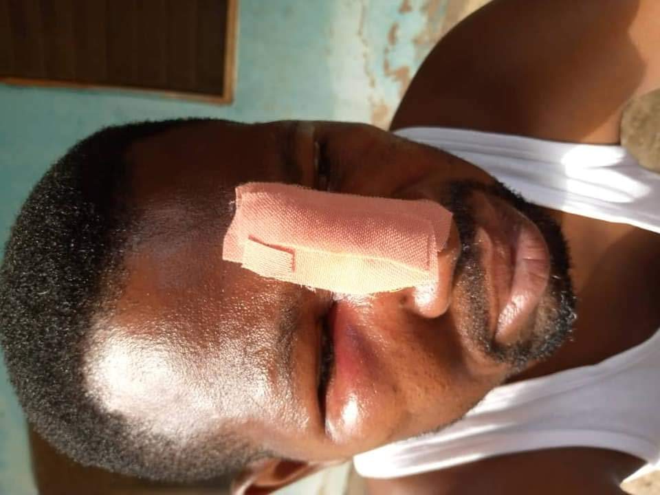 Teacher Beaten to Pulp by Thugs Brought By JHS Student He Punished Over Homework