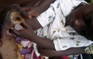 E/R: Palm of 10-yr-old Boy Rotting Due to Financial Challenges, Needs Medical Help