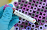 428 New COVID-19 Cases Confirmed