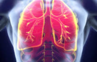 Pneumonia Kills 31 People In Asamankese Government Hospital