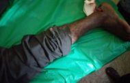 E/R: Flying Roofing Sheet Cuts Ankle of “Loading Boy
