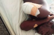 E/R: Family Demands Justice as Arm of Man Broken By Police Officer Amputated