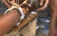 E/R: 28-Yr-Old Student Losing Leg after Horrific Accident