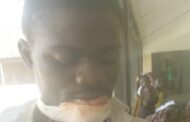 Bibiani: Lip of 28 Years Old Chewed Over GH¢ 2 Alcohol Change