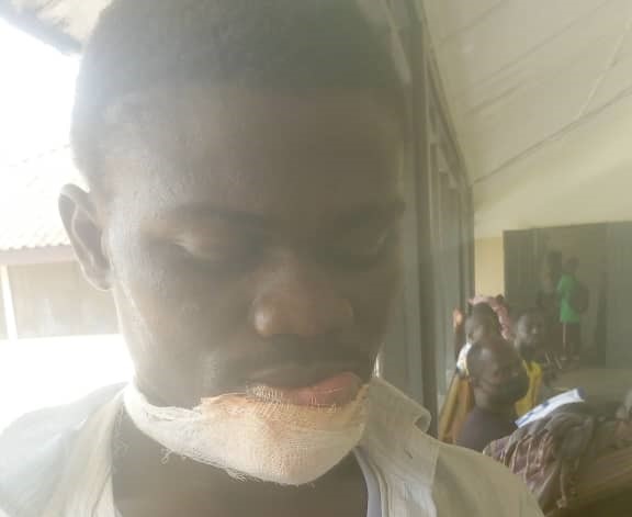 Bibiani: Lip of 28 Years Old Chewed Over GH¢ 2 Alcohol Change