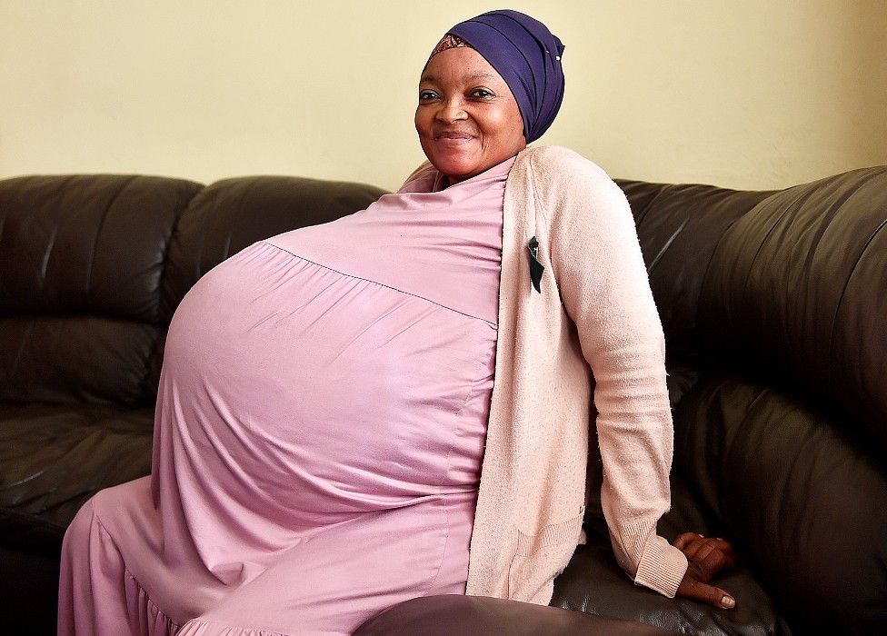 South African Woman Gives Birth to 10 Babies in Pretoria