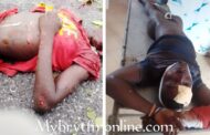 E/R: Motorbike Collides Head-On With Taxi, Two Dead