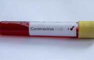 COVID-19 Kills 812 in Ghana, 12 in Critical Condition