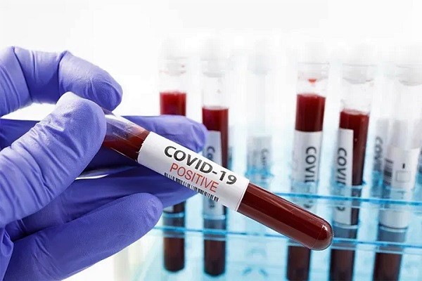 Ghana COVID-19 Active Cases Surges