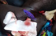 Gomoa Dago: Man Attacks Girl, 10, with Cutlass for Sitting in Front of His Door