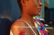 Nkawkaw: Bleeding Woman Rushes to the Police Station after Cutlass Attack by Boyfriend