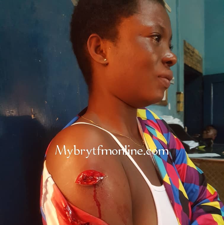 Nkawkaw: Bleeding Woman Rushes to the Police Station after Cutlass Attack by Boyfriend