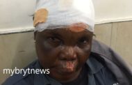 Koforidua: City Guard Sustains Injuries after Tricycle Rider Cause Her Ejection While Speeding