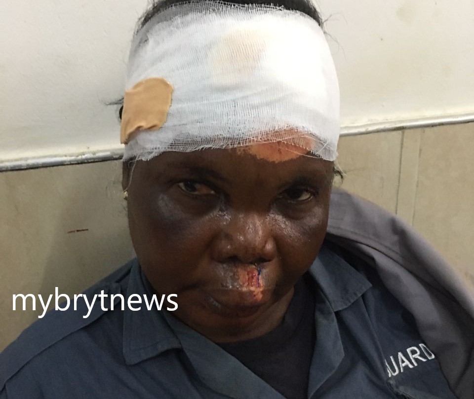 Koforidua: City Guard Sustains Injuries after Tricycle Rider Cause Her Ejection While Speeding