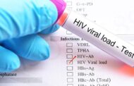 Covid-19 Pandemic Cause of Resurgence of HIV Cases in E/R - AIDS Commission