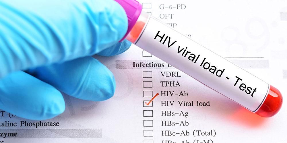 Covid-19 Pandemic Cause of Resurgence of HIV Cases in E/R - AIDS Commission