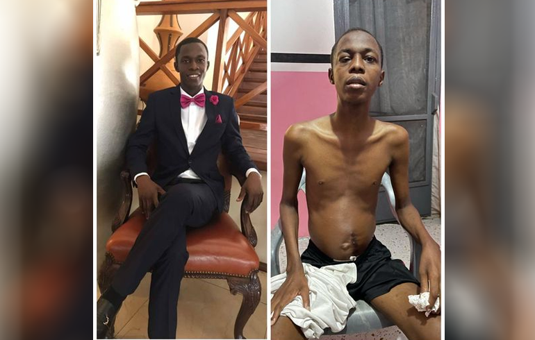 Meet The 36-Year Old Man Who Needs 50K To Undergo Brain Tumor Surgery