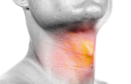 Avoiding Vocal Disorders: Desist Smoking And Reduce Intake Of Caffeinated Drinks – Speech Therapist