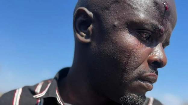 Zimbabwe Reporters Beaten and Made To Delete Footage