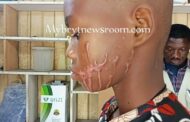 Koforidua: Carpenter in Court for  Attacking Boy, 14, with Acid