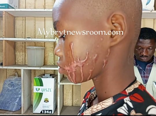 Koforidua: Carpenter in Court for  Attacking Boy, 14, with Acid