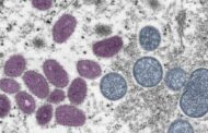 Sudan Confirms Its First Case of Monkeypox