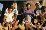 The Vandoma People Of Zimbabwe Have Only Two Toes