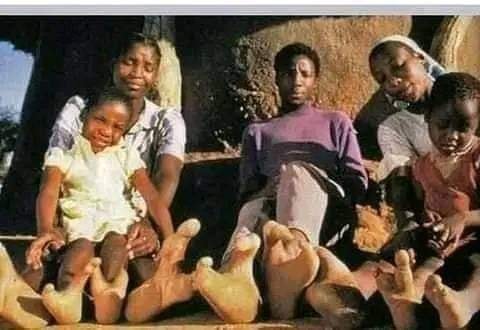 The Vandoma People Of Zimbabwe Have Only Two Toes