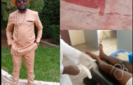 E/R Police Commander Visits Victim of Akropong Chieftaincy Shooting Incident