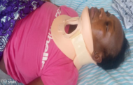 The Story Of Anita Yirenkyi, The Mother Of Four Who Needs Ghc70K For Surgery