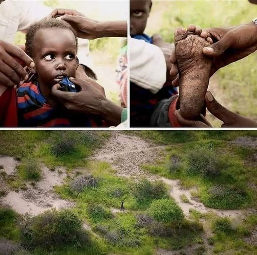 A 4-year Old Kenyan Boy Rescued After Surviving 6 Days In The Wilderness 