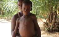 Akyem Kukurantumi: Boy, 7, Dying As Faeces Stuck In Bowel For 7 Years
