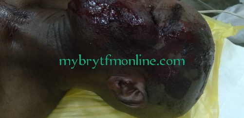 C/R: Woman Butchers Man Over Land Boundary Issues At Awutu Botoku