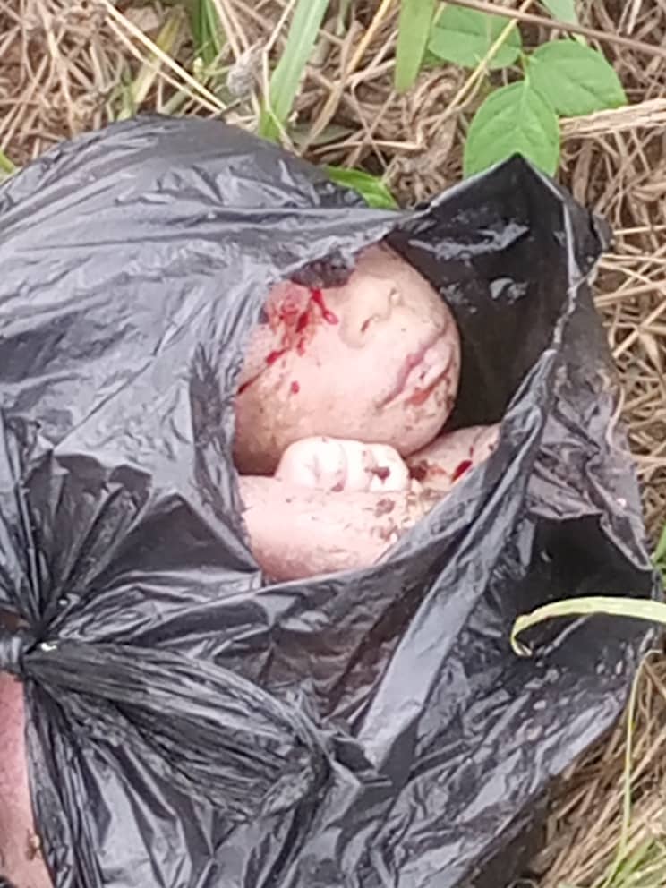 Bono Region: Newly Born Baby Found Dead In  A Polythene Bag At Nkrankwanta District Hospital