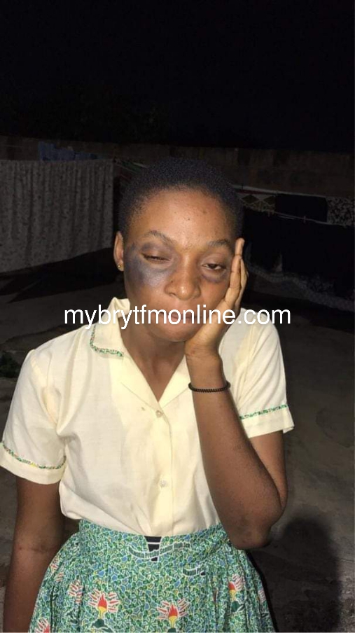 E/R: Female Student Allegedly Slapped By Assistant Headmaster