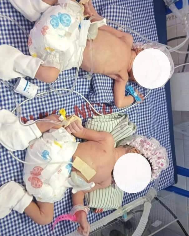 Eastern Regional Hospital Celebrates Rare Quadruplet Delivery