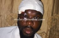 Koforidua: Butcher Struggling For His One Eye After Attack By A Nigerian